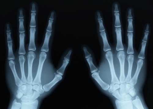 x-ray-hands x-ray-hands