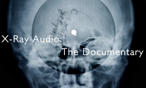 How Soviet bootleggers pressed banned records onto X-ray film